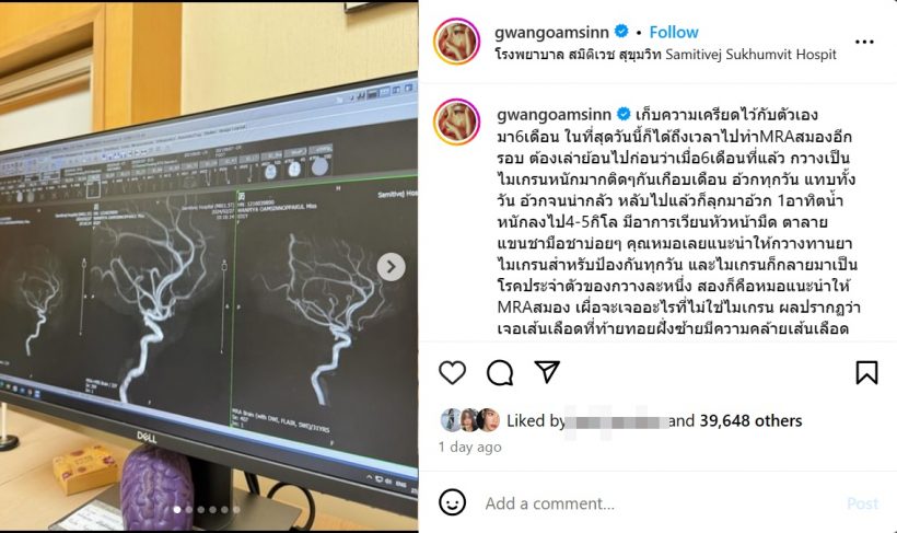 ดาราสาวโล่งใจ ตรวจไม่พบเส้นเลือดในสมองโป่งพอง