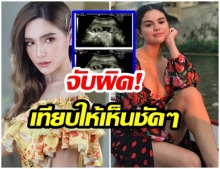 ซาร่า โป๊ะอีกแล้ว! ภาพอัลตร้าซาวด์ทำไม เหมือนของ เซเลน่า  โกเมซ