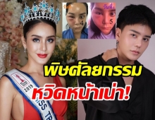 ช็อก! มิสทรานยูนิเวิร์สไทยแลนด์ ศัลยกรรมทำพิษ หวิดหน้าเน่า!