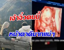 ทุกคนฟันธง! ลูกดาราสาวกับสามีคนนี้ หน้าตาดีชัวร์