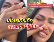 เดินอยู่ดีๆก็เจ็บฟรี! นางเเบบสาวไทย ถูกกระเป๋าฟาดหน้ากลางLA