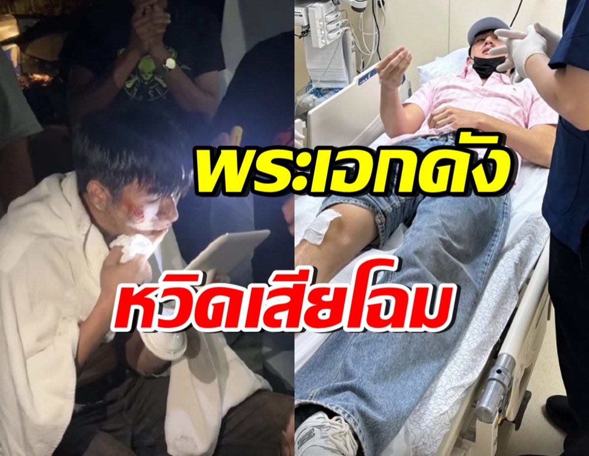 อุบัติเหตุไม่คาดฝัน! พระเอกหนุ่มดัง เจ็บตัวขณะถ่ายภาพยนตร์