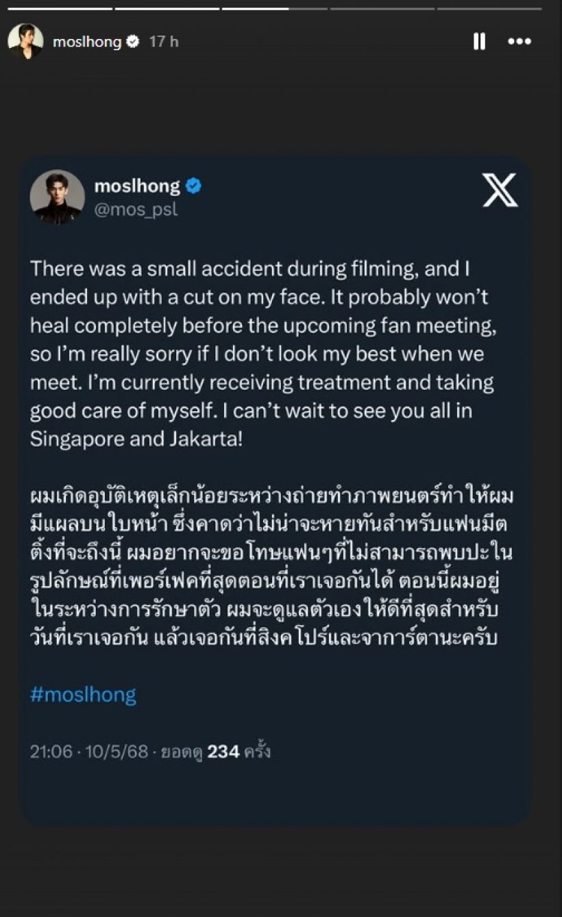 อุบัติเหตุไม่คาดฝัน! พระเอกหนุ่มดัง เจ็บตัวขณะถ่ายภาพยนตร์