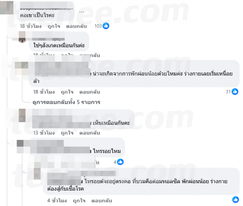 เเฟนๆเป็นห่วง บอย ปกรณ์ หลังพบสิ่งผิดปกติที่บริเวณลำคอ