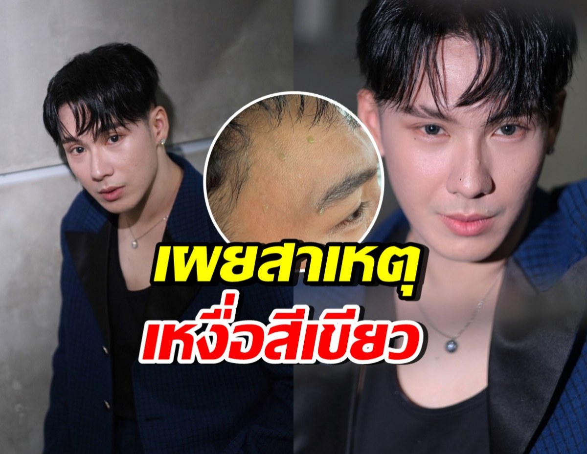 เปิดคำตอบคุณหมอ ทำไมเหงื่อ ตั้ม วราวุธ เป็นสีเขียว?