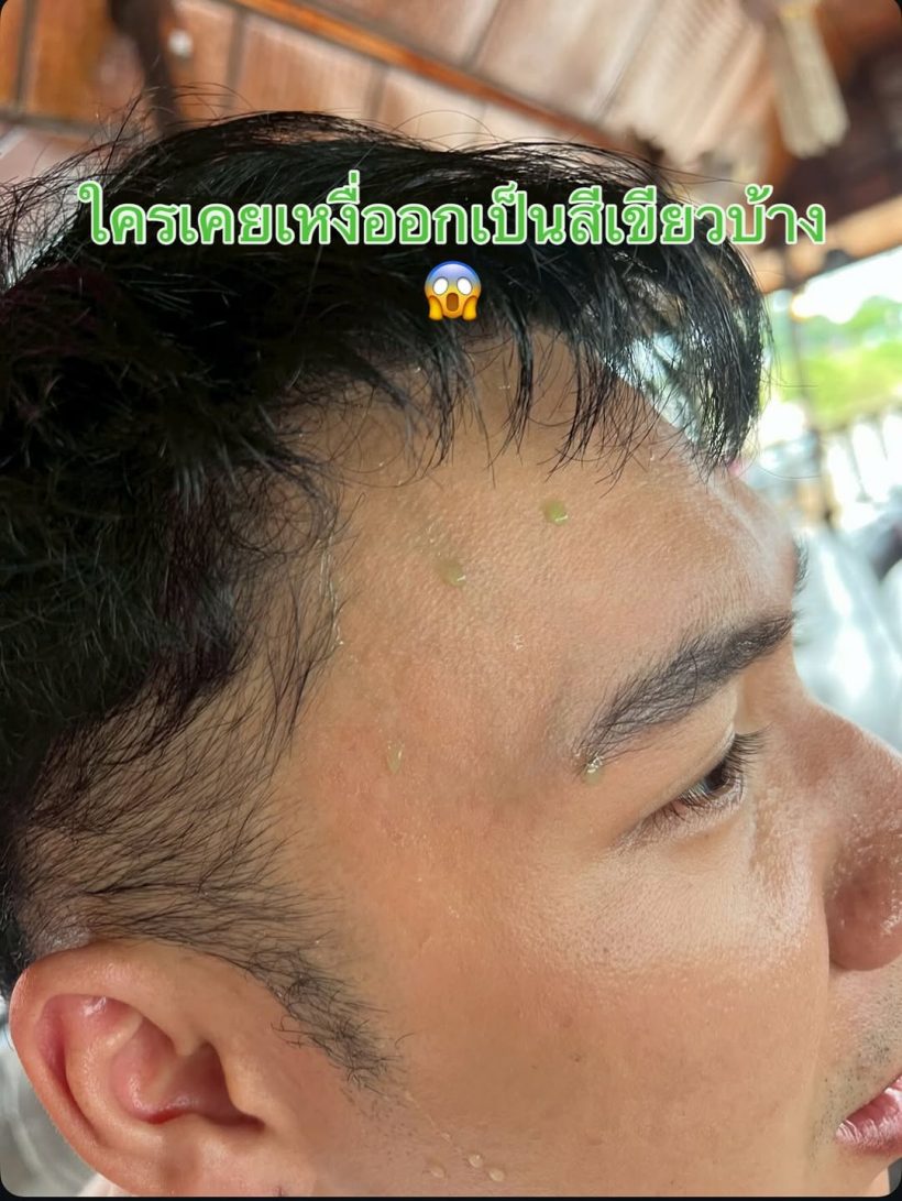 เปิดคำตอบคุณหมอ ทำไมเหงื่อ ตั้ม วราวุธ เป็นสีเขียว?