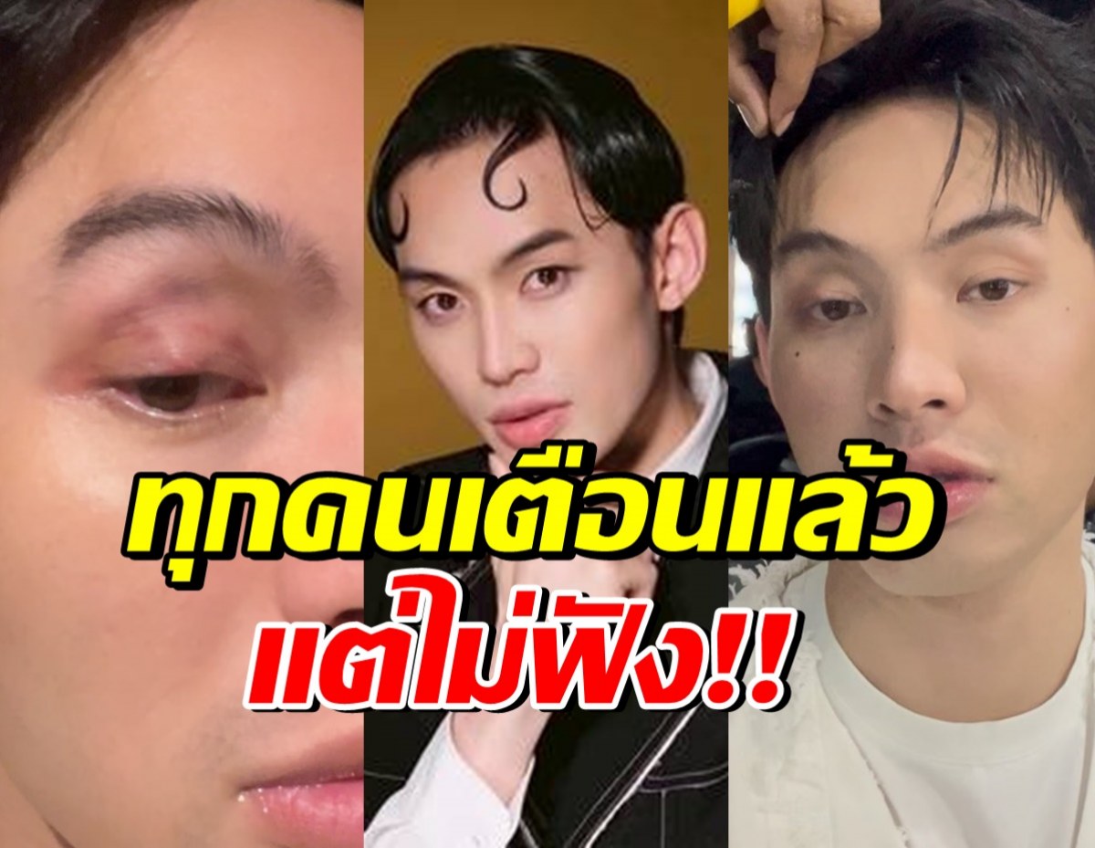 เตือนไม่ฟัง! มะตูม เจ็บหนัก หวั่นหายไม่ทันแคสงานที่เกาหลี