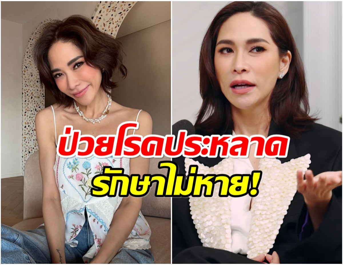 พลอย เฌอมาลย์ เปิดใจป่วยโรคหายาก เเพ้ความเย็นไม่มีทางรักษา