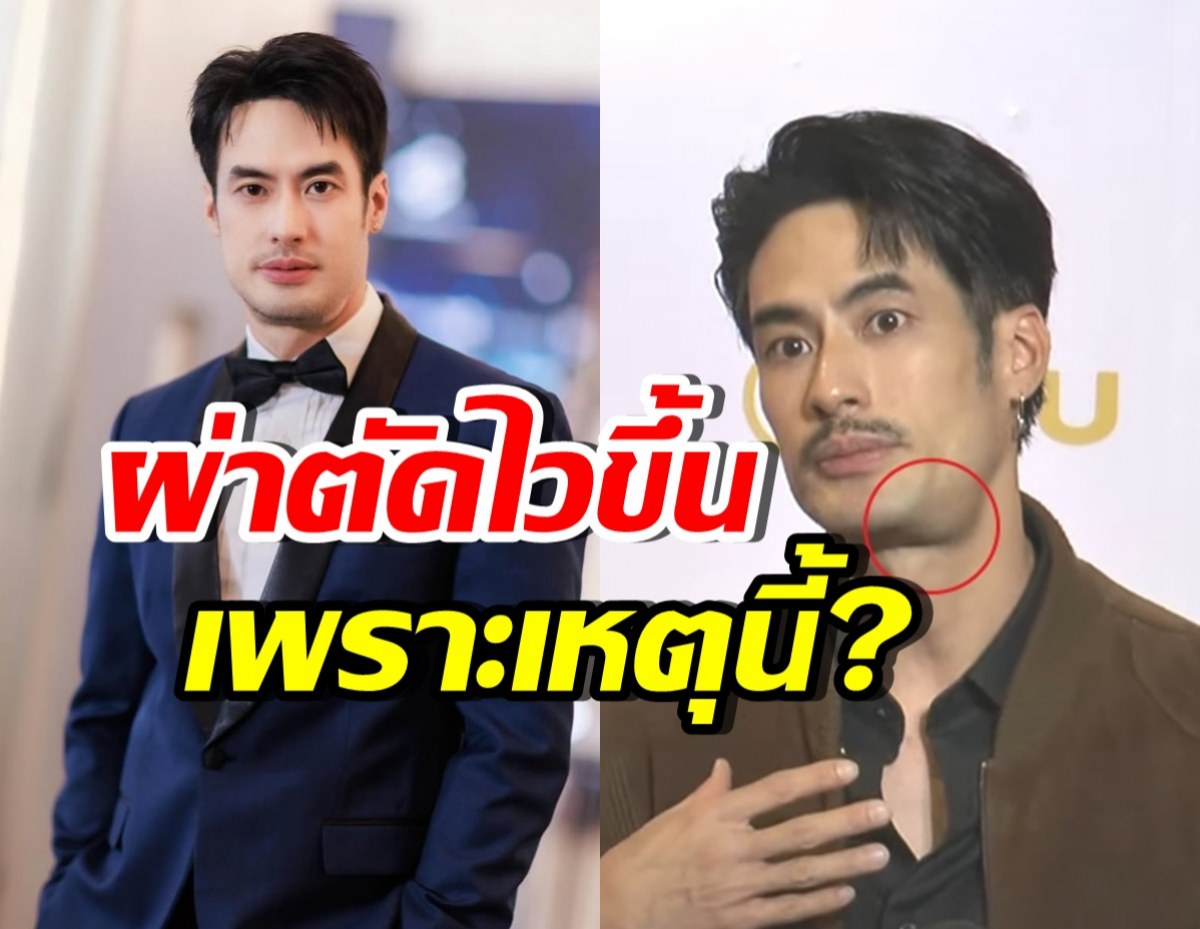 ส่งกำลังใจ บอย ปกรณ์ เผยสาเหตุเลื่อนผ่าตัดให้ไวขึ้น!