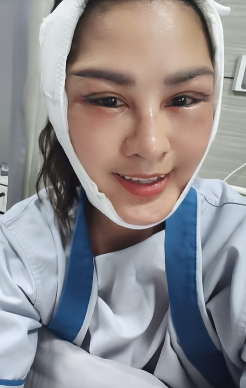 หน้าล่าสุด หญิงลี ศรีจุมพล หลังศัลยกรรม หน้าเด็กลงมาก