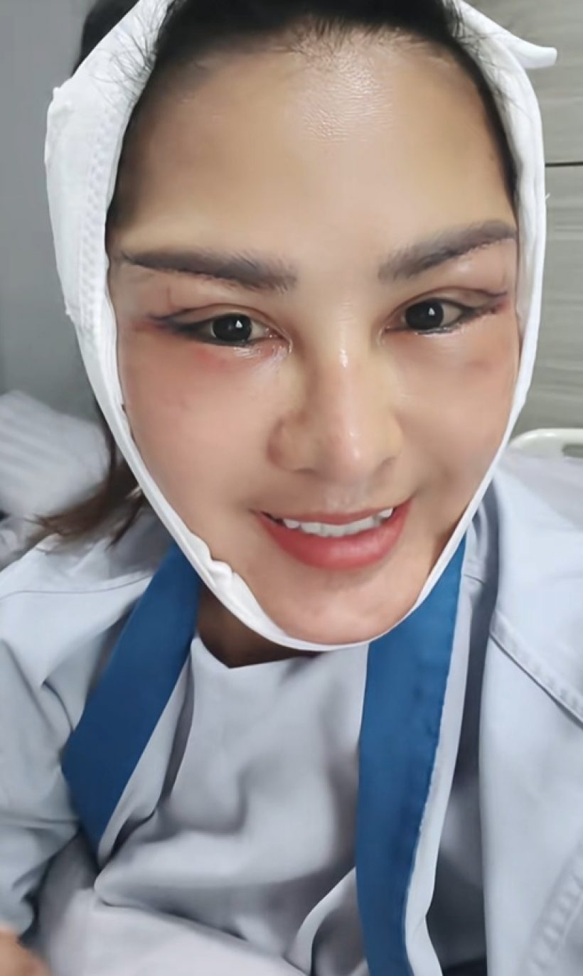 หน้าล่าสุด หญิงลี ศรีจุมพล หลังศัลยกรรม หน้าเด็กลงมาก