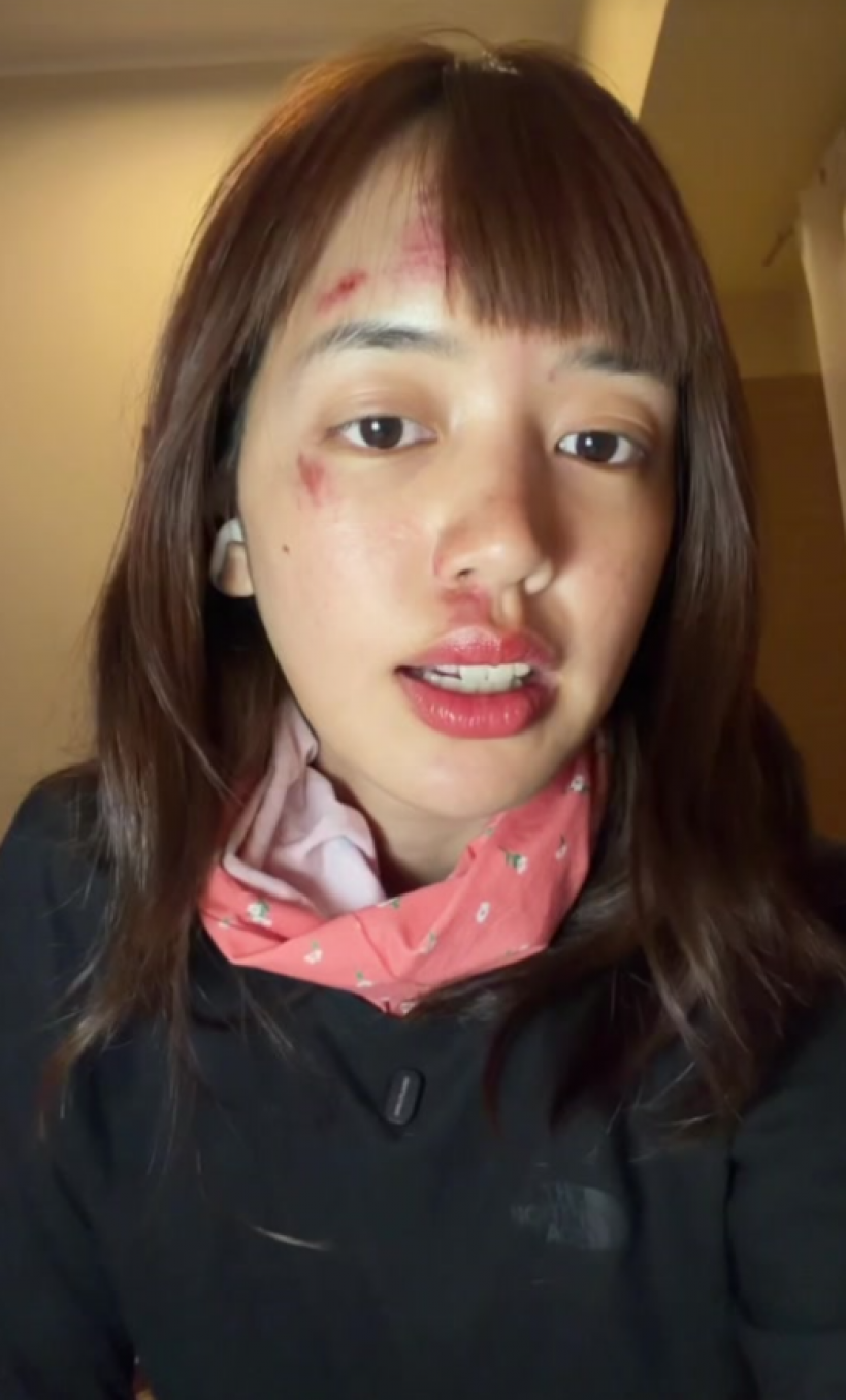 เเฟนๆห่วง พลอยไพลิน หน้าช้ำหลังกลับจากทริปแอนตาร์กติกา