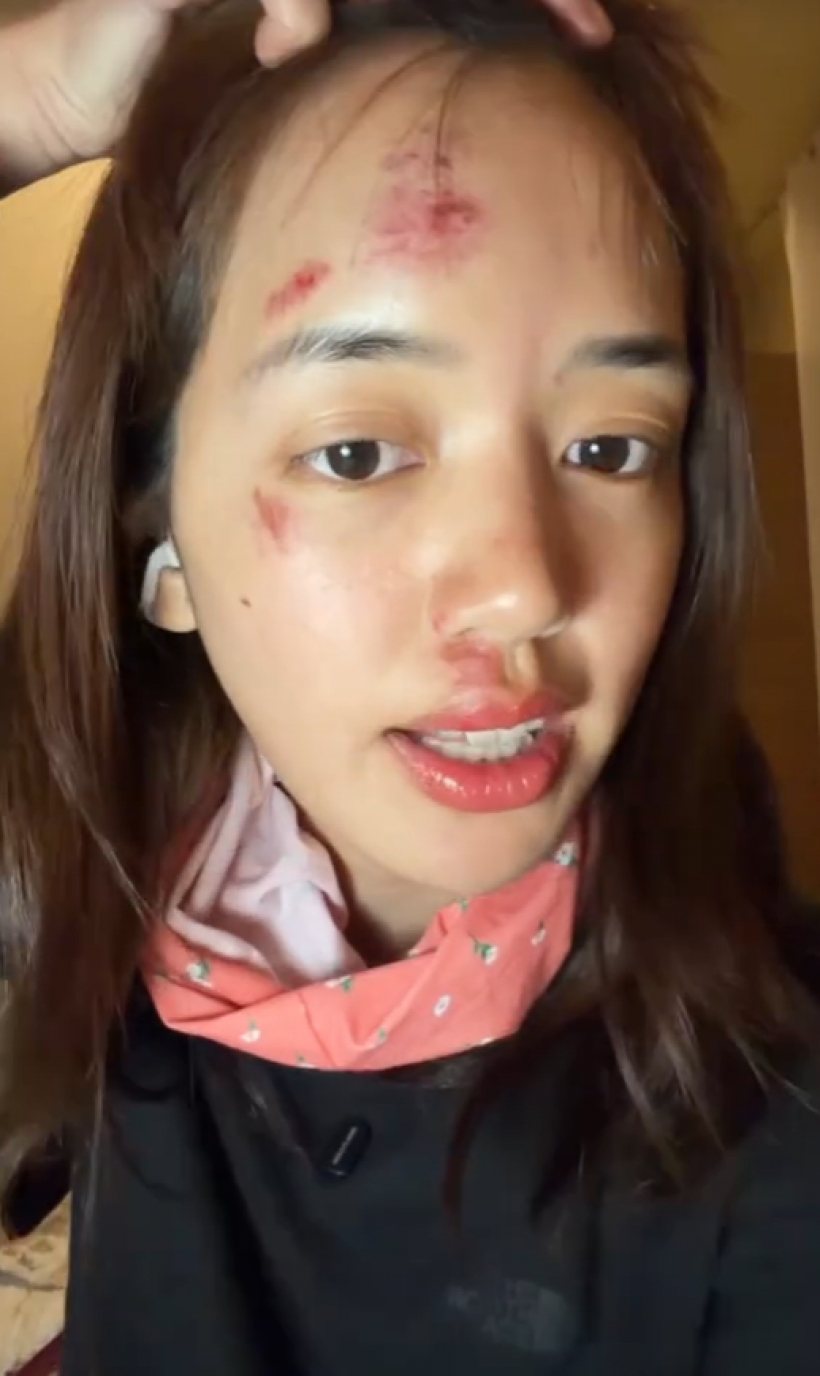 เเฟนๆห่วง พลอยไพลิน หน้าช้ำหลังกลับจากทริปแอนตาร์กติกา