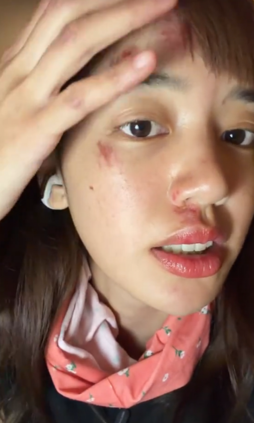 เเฟนๆห่วง พลอยไพลิน หน้าช้ำหลังกลับจากทริปแอนตาร์กติกา