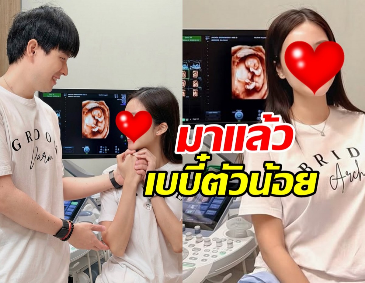 สาวดังเผยภาพอัลตร้าซาวด์ ท้องแล้ว หลังเคยสูญเสียลูก