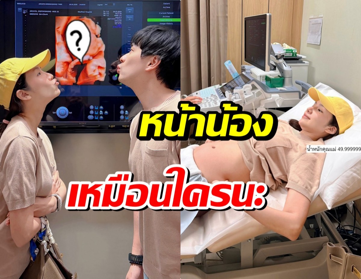 คู่รักดัง เปิดภาพอัลตร้าซาวด์ลูกในท้อง ตื่นเต้นใกล้คลอดเเล้ว!