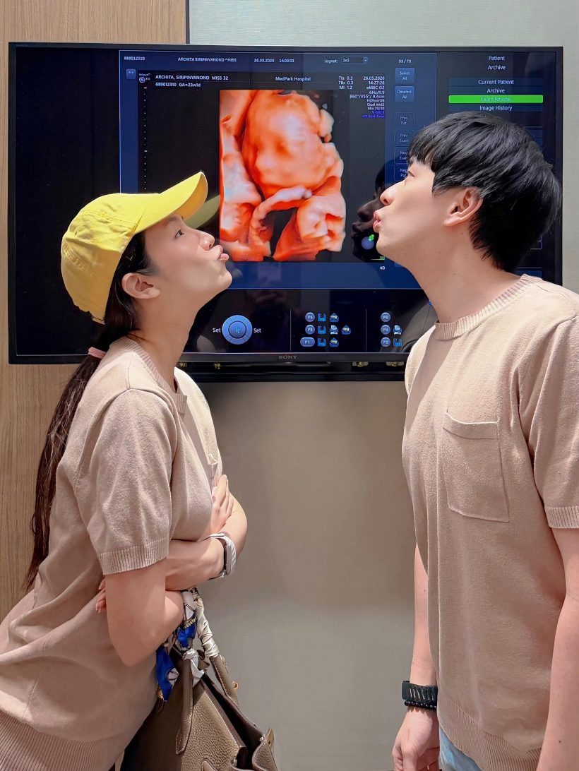 คู่รักดัง เปิดภาพอัลตร้าซาวด์ลูกในท้อง ตื่นเต้นใกล้คลอดเเล้ว!