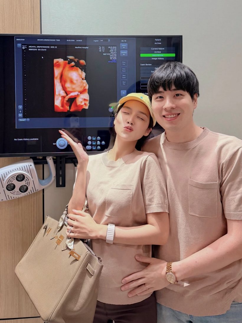 คู่รักดัง เปิดภาพอัลตร้าซาวด์ลูกในท้อง ตื่นเต้นใกล้คลอดเเล้ว!