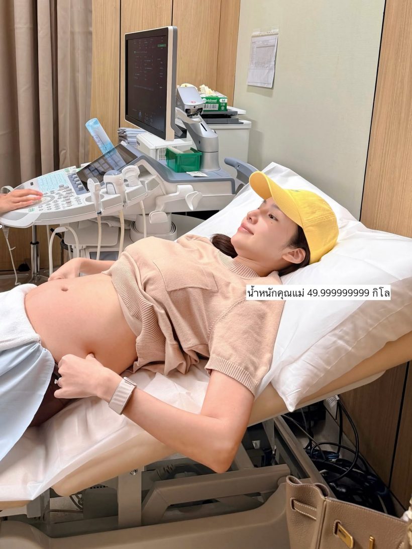 คู่รักดัง เปิดภาพอัลตร้าซาวด์ลูกในท้อง ตื่นเต้นใกล้คลอดเเล้ว!
