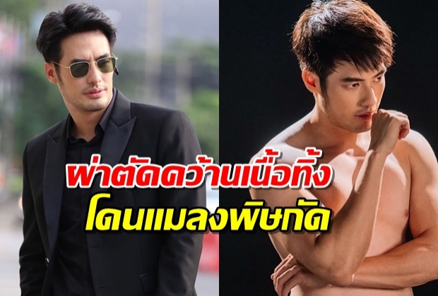 บอย ปกรณ์ ผ่าตัดคว้านเนื้อทิ้ง หลังถูกแมลงมีพิษกัดที่ญี่ปุ่น