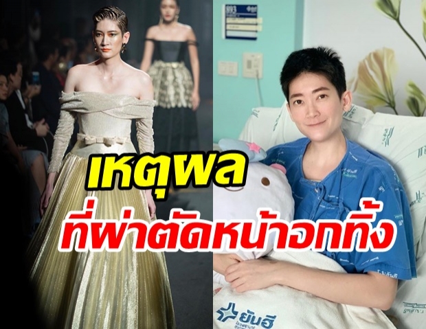 นางแบบสายเท่ ไดญา โทณะวณิก เผยเหตุผลที่ยอมผ่าตัดหน้าอกออก