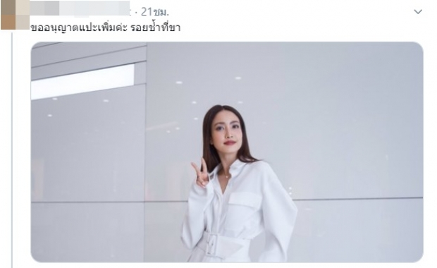 แฟนคลับไม่ทน! แปะภาพ แต้ว ณฐพร ตอกคนถามรอยช้ำมาจากไหน