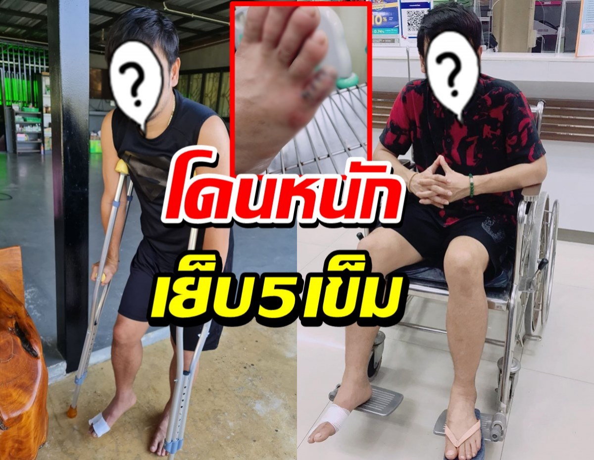 แห่ส่งกำลังใจหลัง นักร้องดังเกิดอุบัติเหตุจนต้องเย็บ 5 เข็ม