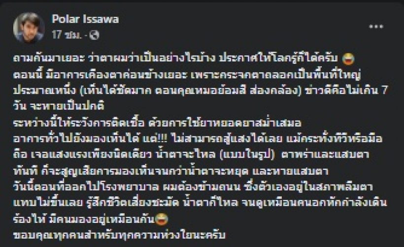 ดาราหนุ่มมาดเข้ม กระจกตาถลอกหนัก หลังโดนลูกลิงตะปบ