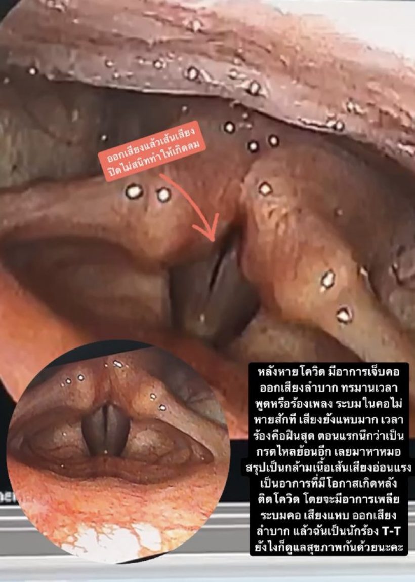 แฟนๆสุดห่วงนักร้องดังตัดพ้อ ร่างกายผิดปกติหลังหายป่วยโควิด