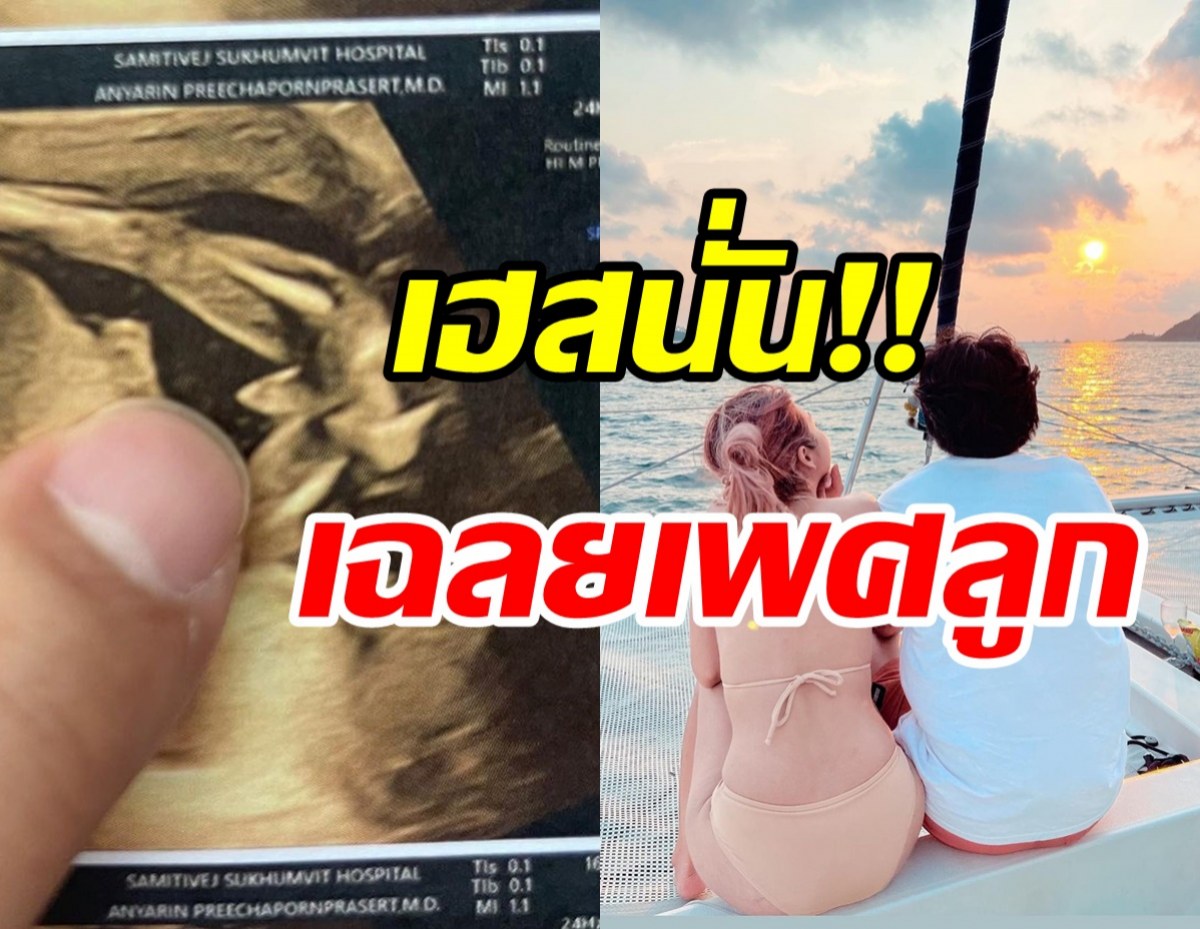 ยินดีด้วย!! นักร้องสาวเผยข่าวดีเฉลยเพศลูกเห็นชัดตั้งแต่ในท้อง