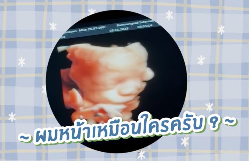 มะปราง วิรากานต์ อวดห้องต้อนรับลูกชาย ลุ้นคลอดธรรมชาติ