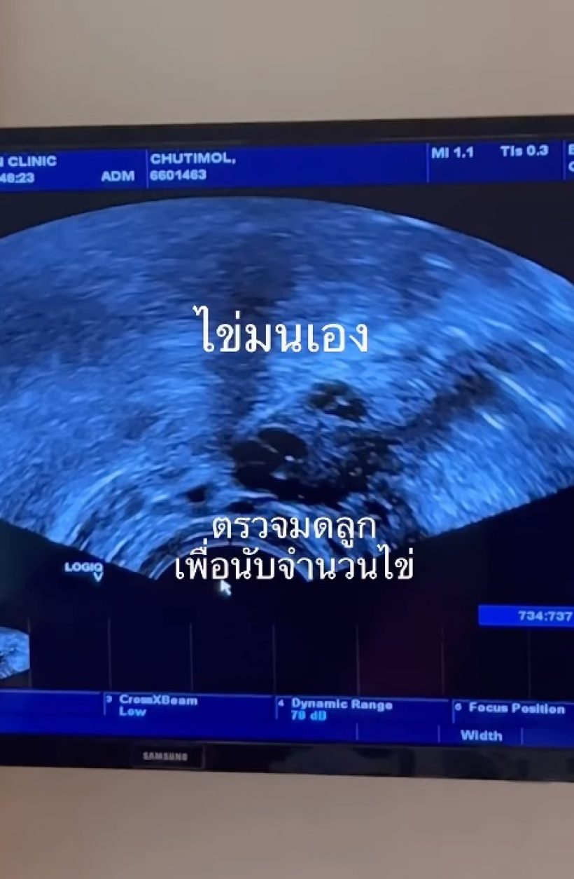  รอฟังข่าวดี! คู่รักนักร้องแต่งงาน6ปี พร้อมจะเป็นพ่อแม่มือใหม่แล้ว