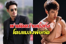 บอย ปกรณ์ ผ่าตัดคว้านเนื้อทิ้ง หลังถูกแมลงมีพิษกัดที่ญี่ปุ่น