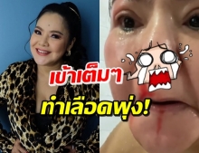 ‘ฮาย อาภาพร’ อาบน้ำอยู่ดีๆ สุดท้ายเลือดไหลเพราะสิ่งนี้!? (คลิป)