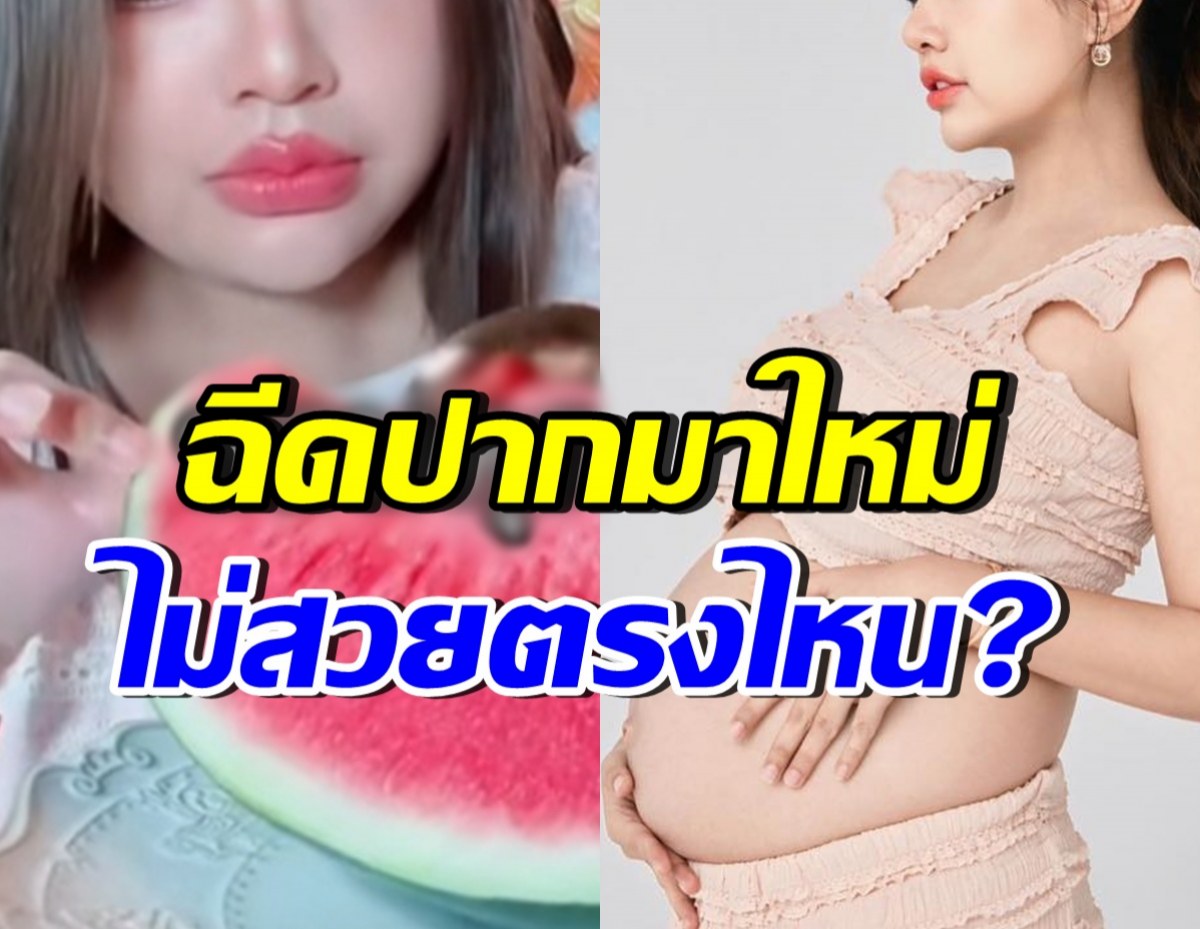 โดนติอีกแล้ว!! ดาราสาวดัง ตอกกลับคนทัก ฉีดปากแล้วไม่สวย