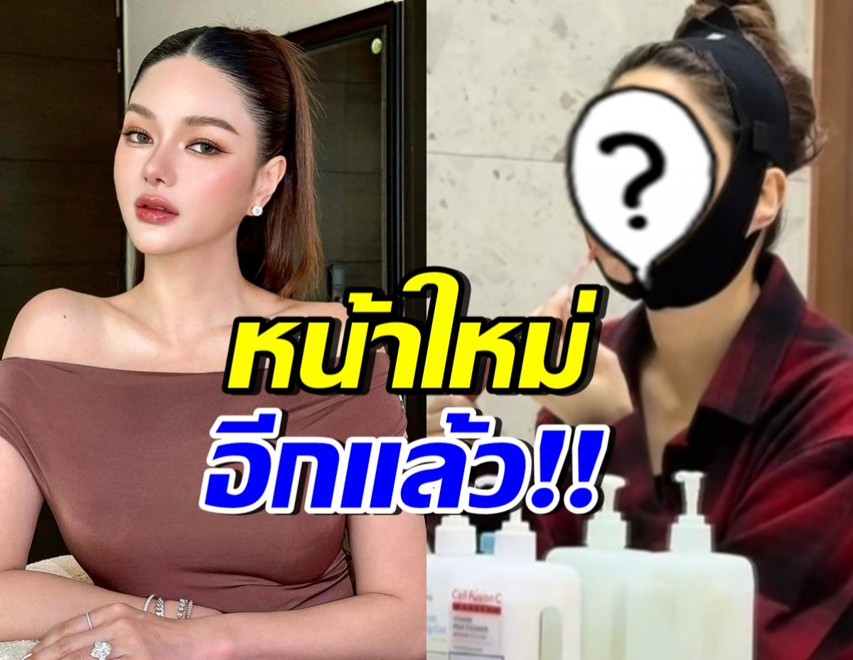กวาง เดอะเฟซ หน้าล่าสุดทำอึ้ง!! บินลัดฟ้าศัลยกรรมอีกแล้ว