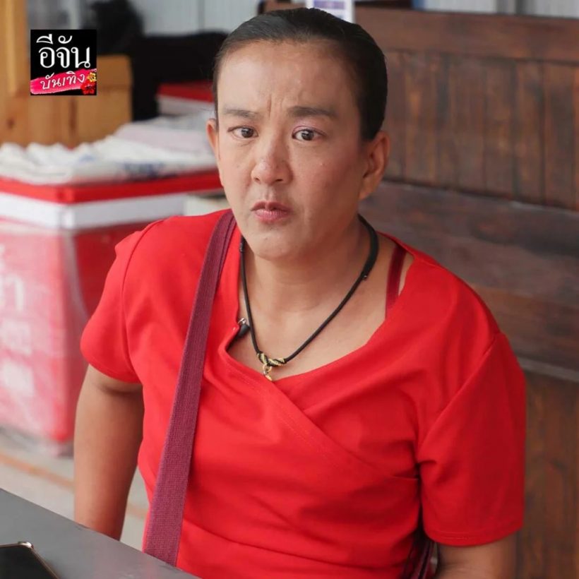 ภาพล่าสุดตลกดัง ตาหวาน ได้ดวงตาใหม่ แทบจำหน้าเดิมไม่ได้
