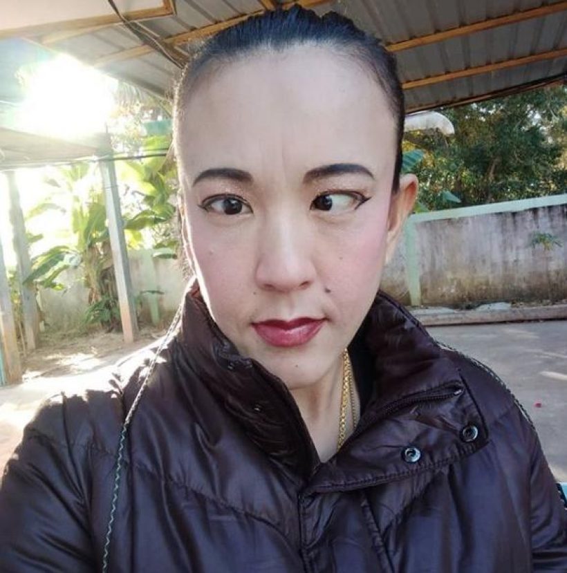 ภาพล่าสุดตลกดัง ตาหวาน ได้ดวงตาใหม่ แทบจำหน้าเดิมไม่ได้
