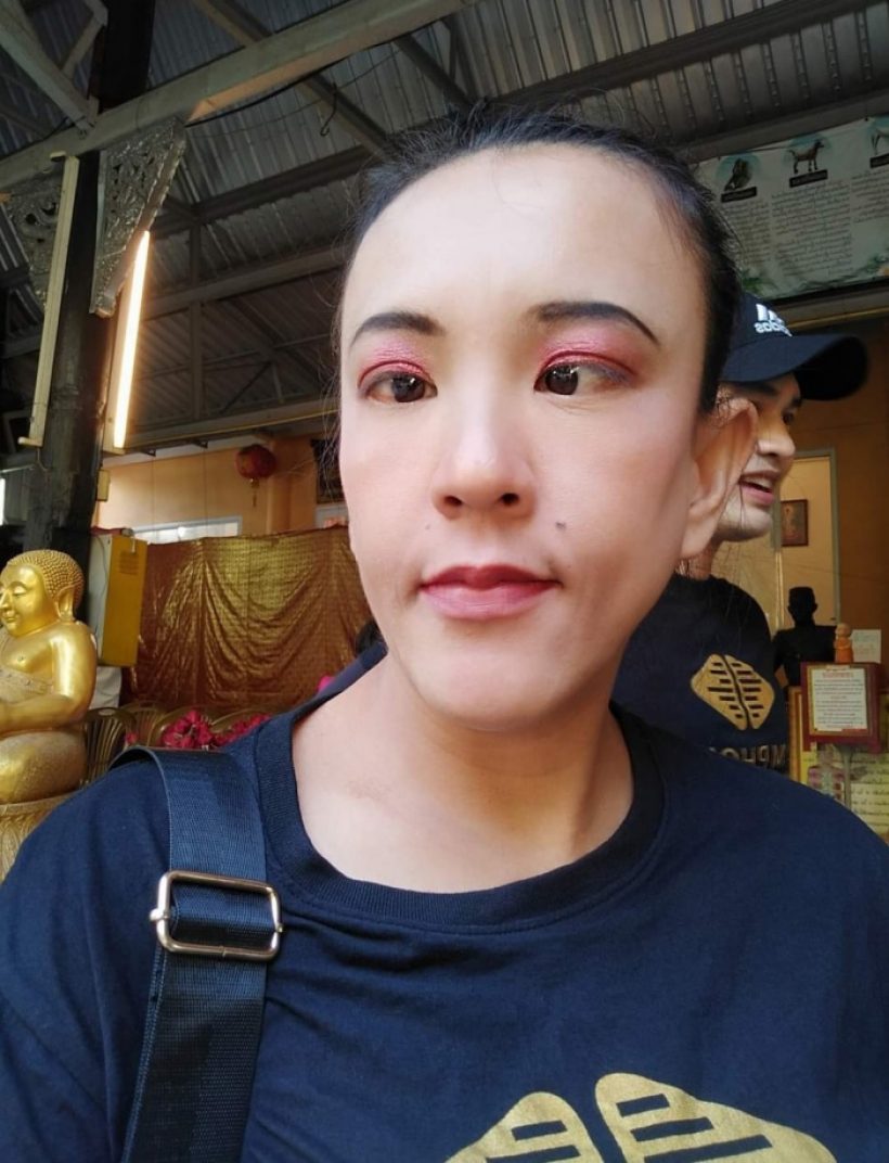 ภาพล่าสุดตลกดัง ตาหวาน ได้ดวงตาใหม่ แทบจำหน้าเดิมไม่ได้