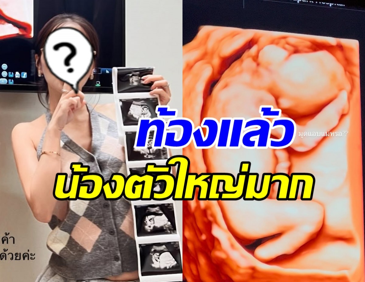 กรี๊ด! ดาราสาวดัง อวดภาพอัลตร้าซาวด์เบบี๋ ท้อง3เดือนแล้ว