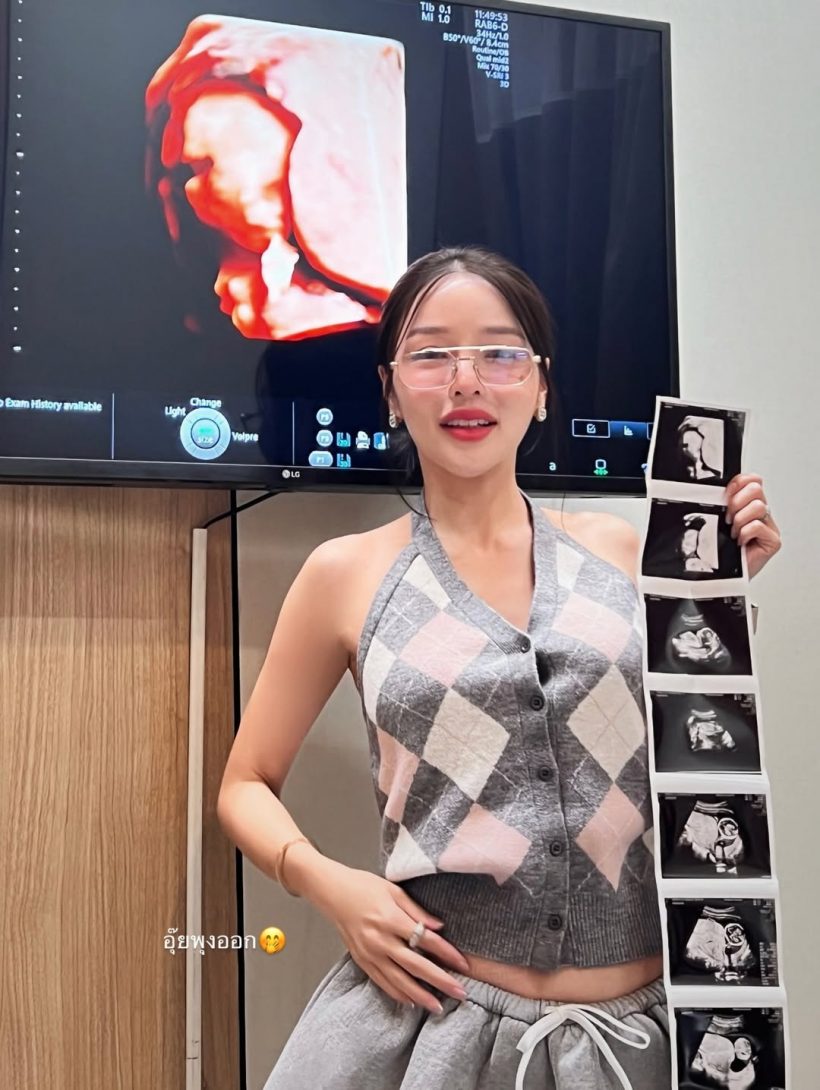 กรี๊ด! ดาราสาวดัง อวดภาพอัลตร้าซาวด์เบบี๋ ท้อง3เดือนแล้ว
