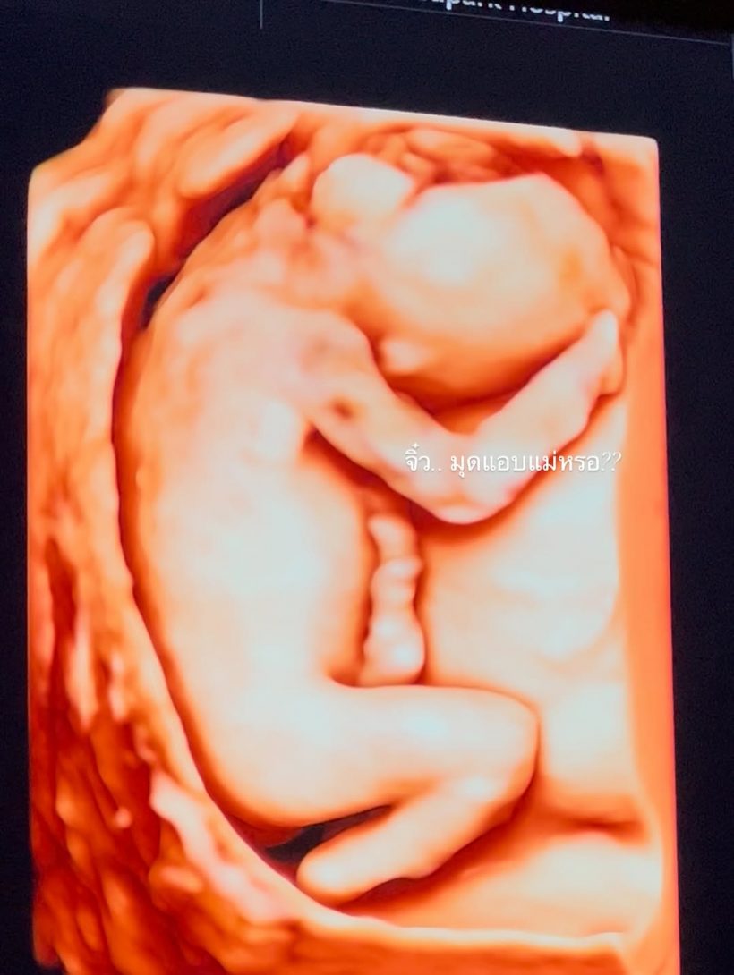 กรี๊ด! ดาราสาวดัง อวดภาพอัลตร้าซาวด์เบบี๋ ท้อง3เดือนแล้ว