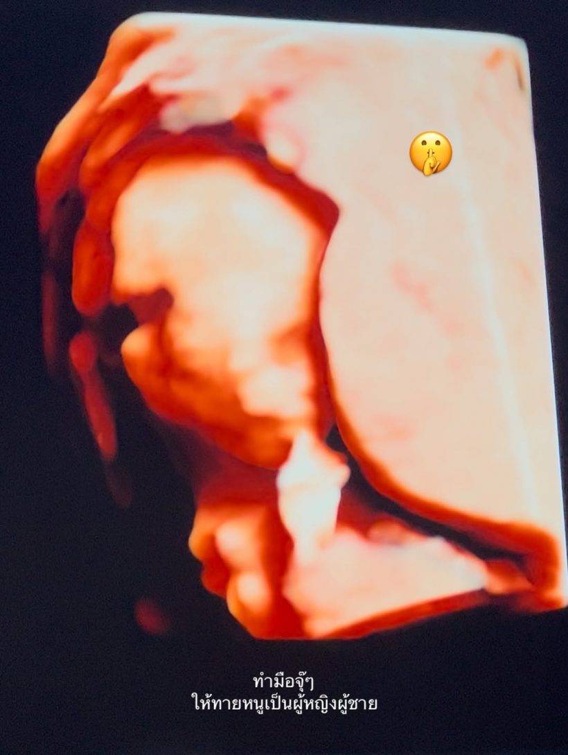 กรี๊ด! ดาราสาวดัง อวดภาพอัลตร้าซาวด์เบบี๋ ท้อง3เดือนแล้ว