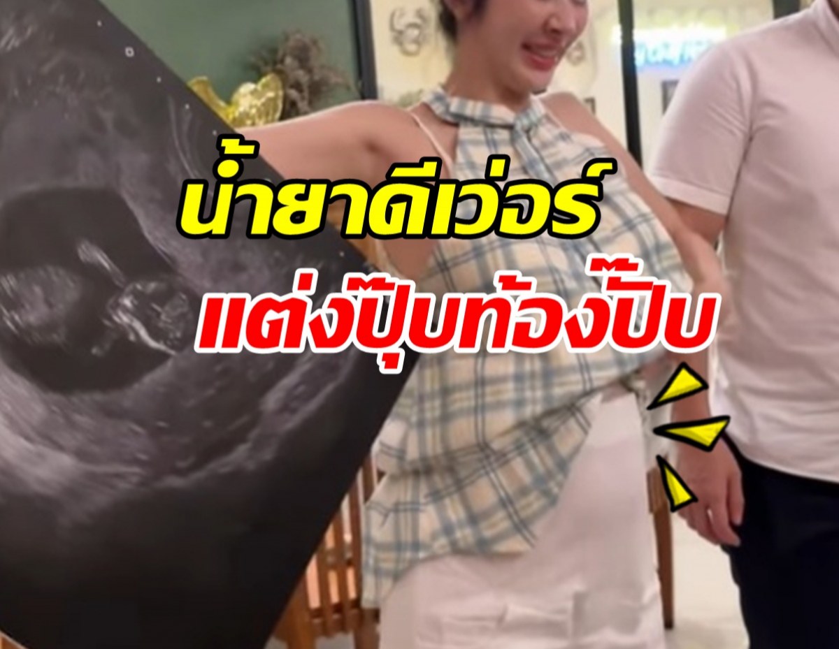 แซ่ซ้องยินดี! สาวสวยชื่อดัง ท้องแล้ว หลังเพิ่งแต่งไม่นาน
