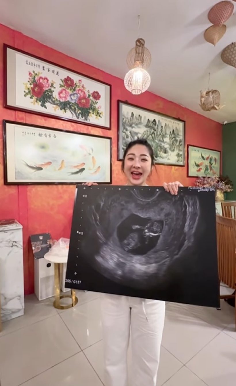 แซ่ซ้องยินดี! สาวสวยชื่อดัง ท้องแล้ว หลังเพิ่งแต่งไม่นาน