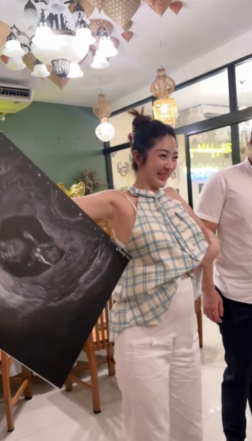 แซ่ซ้องยินดี! สาวสวยชื่อดัง ท้องแล้ว หลังเพิ่งแต่งไม่นาน