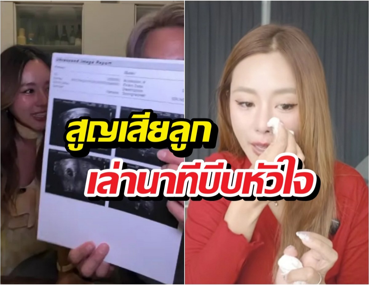 นางเอกดัง ใจสลาย เล่านาทีบีบหัวใจสูญเสียลูกในท้อง