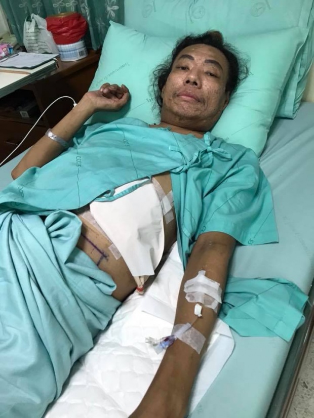 ดารา-แฟนคลับ บริจาคเงินช่วย “ไข่มุข ซุปตาร์”ป่วยมะเร็ง แบกค่ารักษานับล้าน ล่าสุดโทรมหนัก