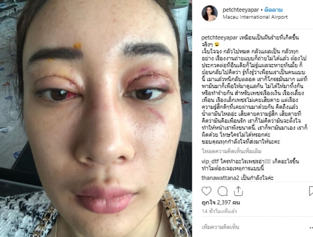 ‘น้ำเพชร’ แฉซ้ำ!เพื่อนรักจงใจตบหน้าแหกเสียงแรงทำมาสุดท้ายพังยับเยิน!