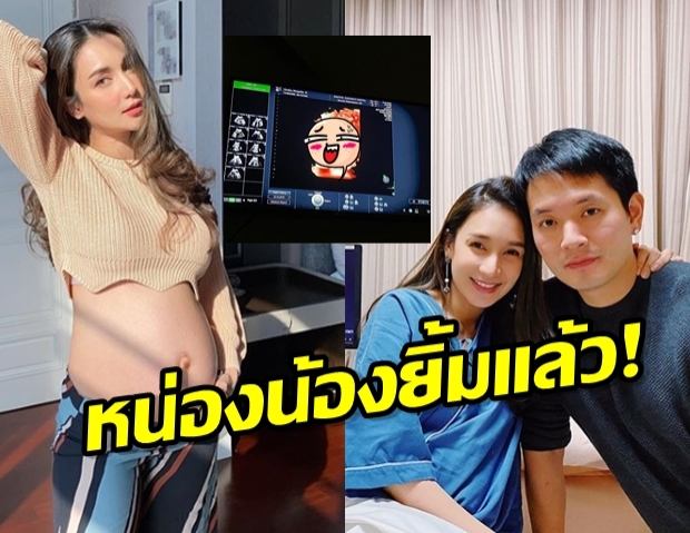 ส่องหน่องน้อง เนย โชติกา อัลตราซาวน์4D ชัดเป๊ะ นี่น้องหรือพี่อคิณ !